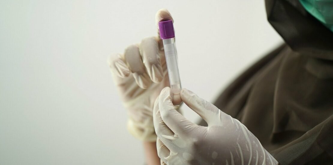 tst-condena-empresa-por-exigir-teste-de-hiv-em-contratacao